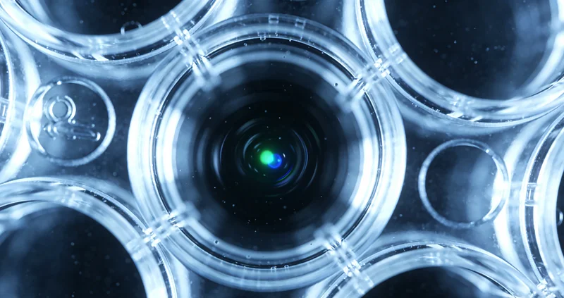 科左中旗儿童眼科检查与白瞳症示