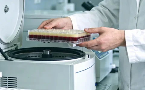 开远因子XI缺乏基因检测正规机构合集（地址汇总）