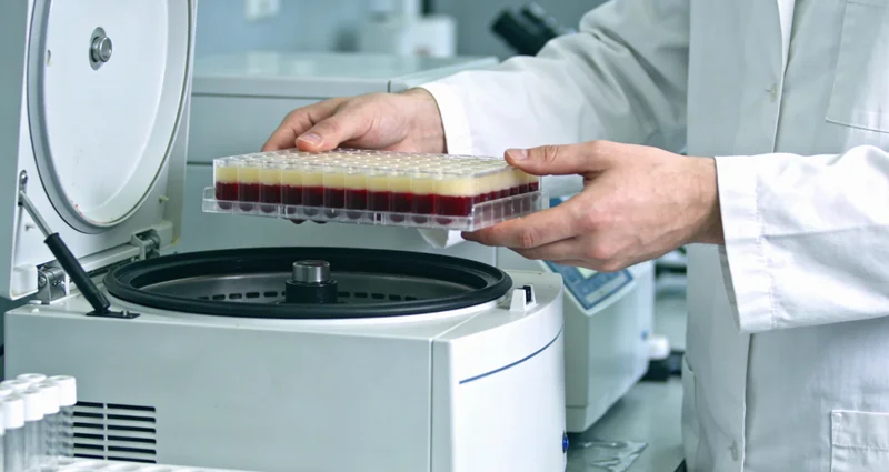 开远居民了解凝血因子XI缺乏与