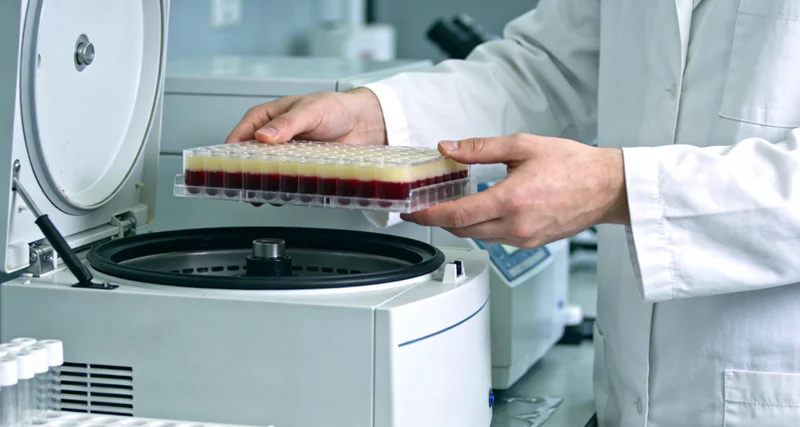 新右旗儿童皮肤咖啡牛奶斑示意图