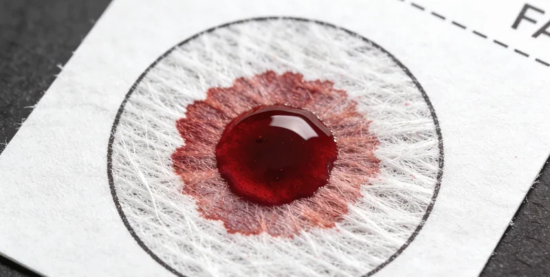 马尔康医院基因检测抽血采样流程