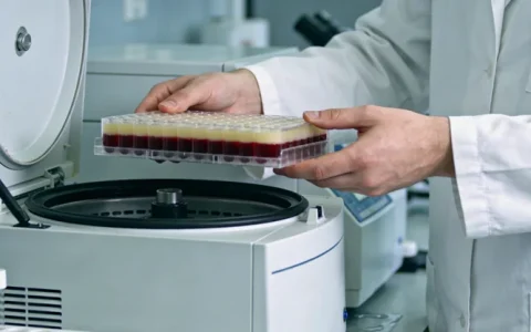 六安黑斑息肉综合征基因检测哪家机构好？排名一览