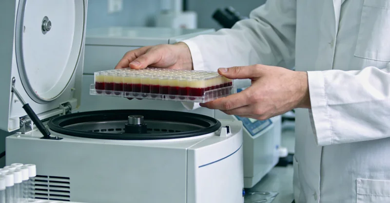 六安孩子嘴唇周围黑斑与普通胎记