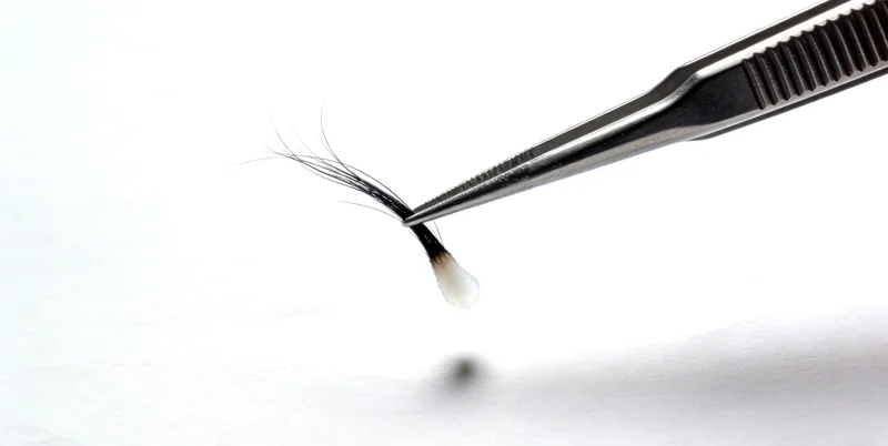 嘉峪关 LDLR基因检测原理示