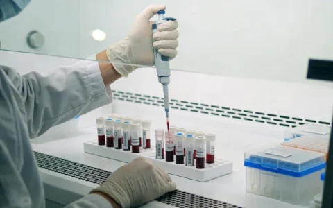 榆林小叶性乳腺癌风险基因检测办理点地址在哪？