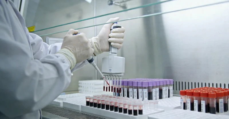 阿图什健康管理 结肠镜检查示意