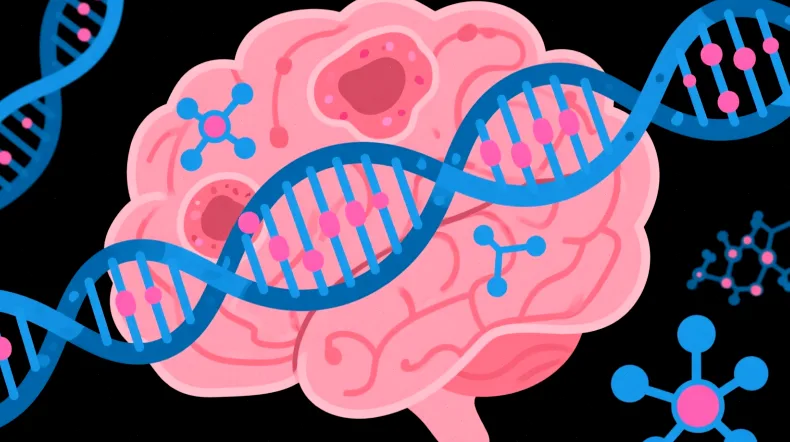 髓母细胞瘤四种分子亚型示意图